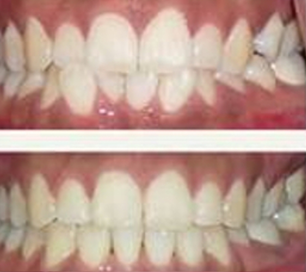 Petulance Proficiency Assets Clinica Ortho Select | Aparate dentare Timisoara |Stomatologie pentru copii  | Ortodontie pentru copii | Albire dentara